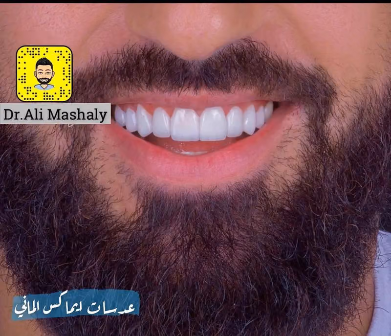 الدكتور على مشالى اخصائي طب الاسنان بعيادات بيرل بحي الندوه