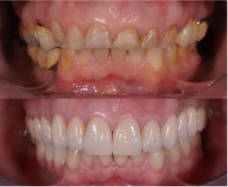 الدكتور باسم ابوكانون ,طب و تجميل الاسنان