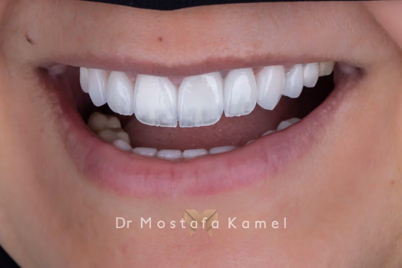 الدكتور مصطفى كامل لتصميم أفضل ابتسامة هوليود