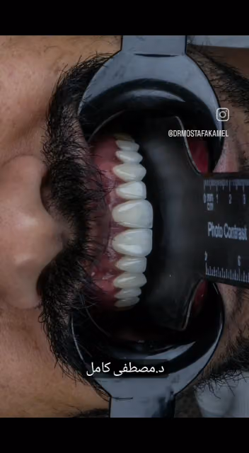 Dr. Mostafa Kamel Lets Design Your Perfect Smileالدكتور مصطفى كامل - تجميل الاسنان و ابتسامه هوليود ...