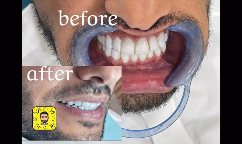 المسواك النرجس لطب الاسنان