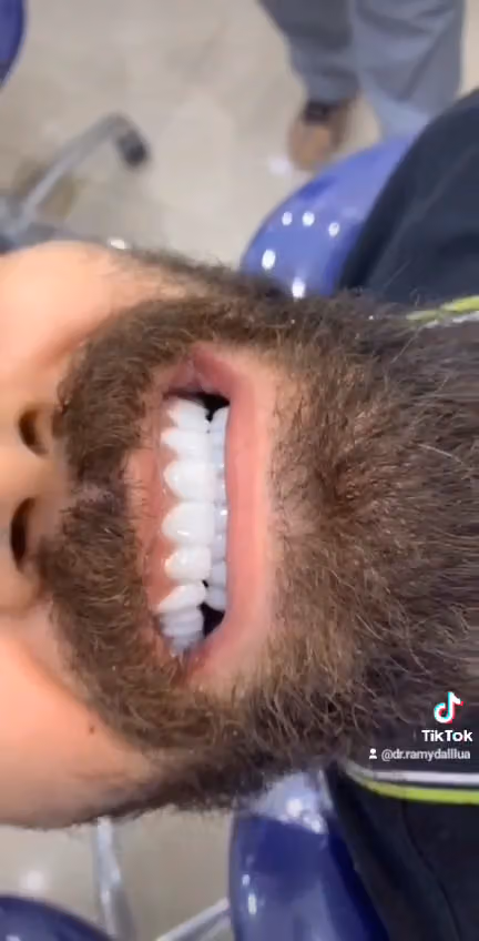 المسواك