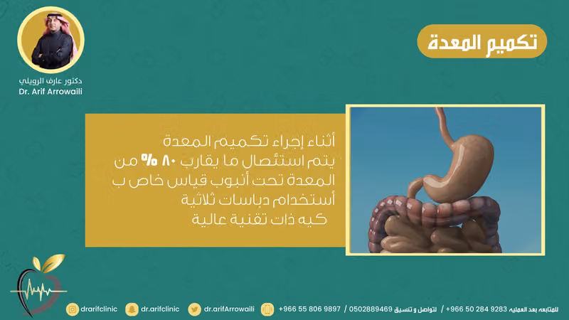 عيادات الدكتور عارف الرويلي لجراحات السمنة