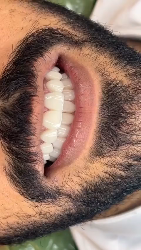عيادات الدكتور محمد عبدالكريم السلامه لطب وتجميل الاسنان
