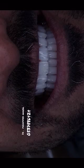 المسواك لطب الأسنان