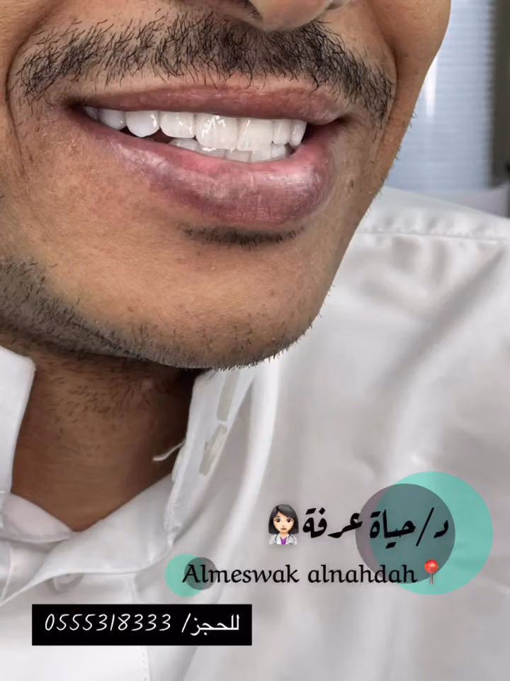 عيادات المسواك الطبية حي النهضة
