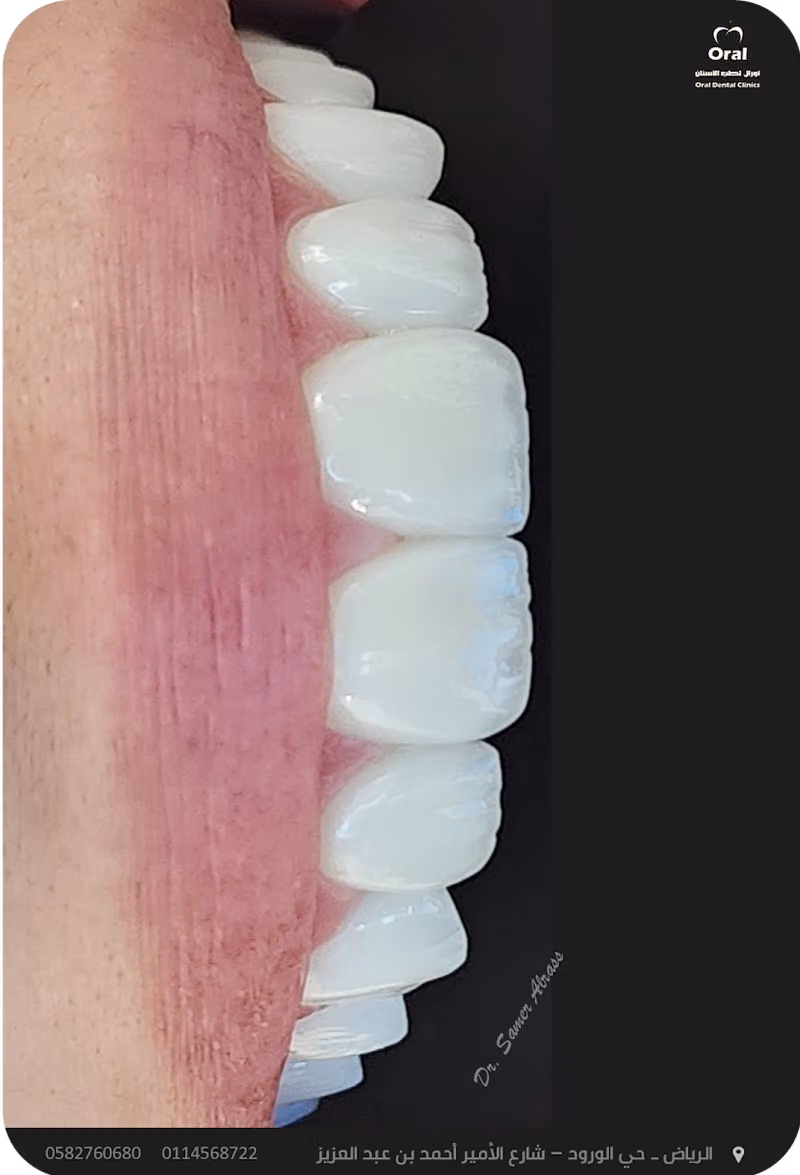 عيادات أورال لطب الأسنان