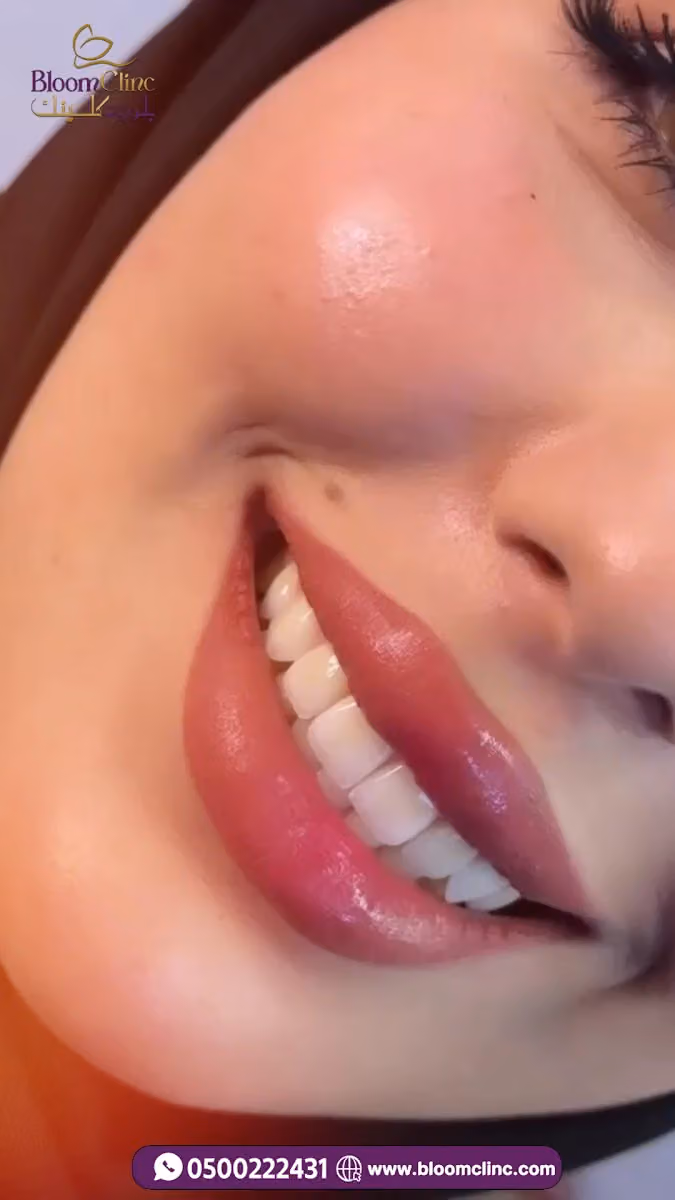 عيادات بلوم كلينك - BLOOMCLINC