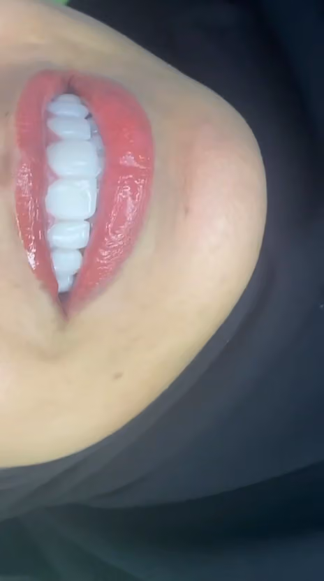 عيادات برايت سمايل