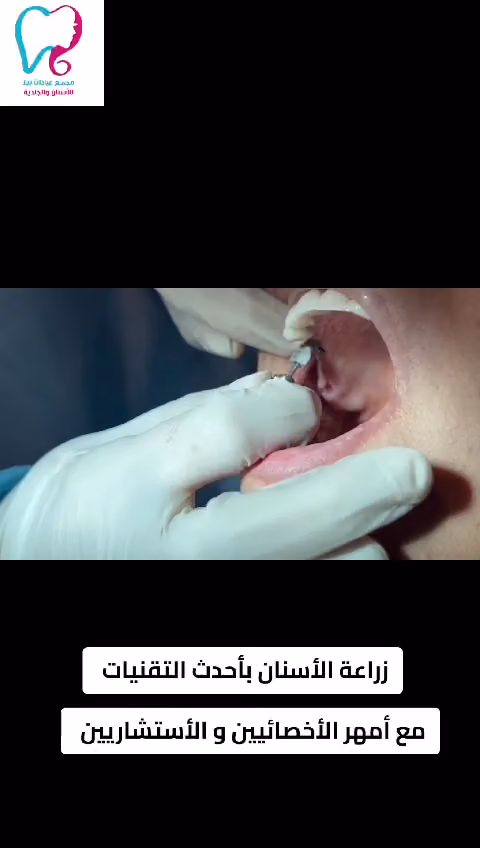 عيادات بيلا للاسنان والجلدية - Bella Clinic