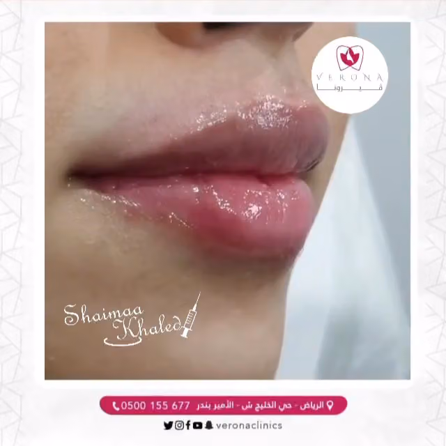 عيادات فيرونا Verona Clinics
