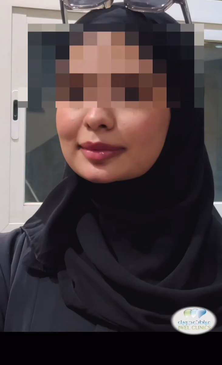 عيادات جويل