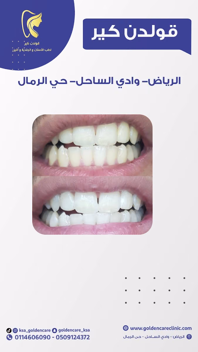 عيادات قولدن كير للأسنان والجلدية والليزر