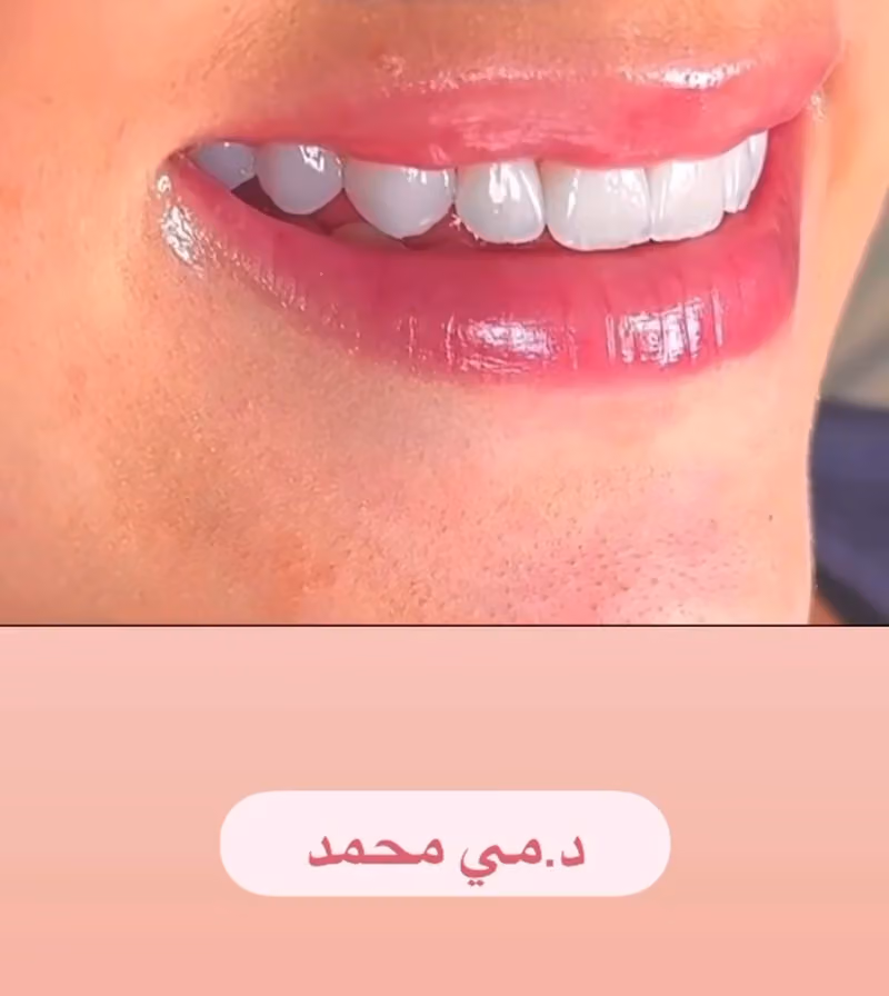 عيادات قولدن كير للأسنان والجلدية والليزر