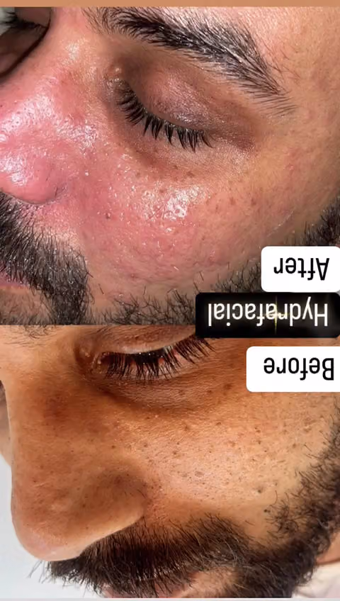 عيادات راما للجلدية والتجميل - فرع التخصصي