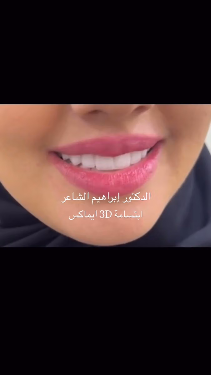 عيادات ريانه دكتور ابراهيم الشاعر لطب الاسنان