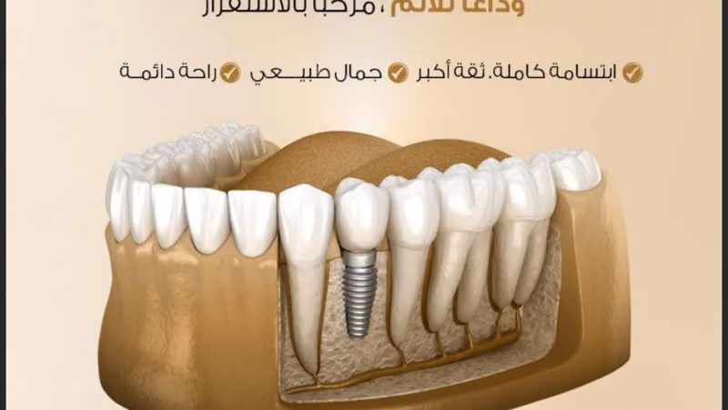 عيادات ريانة - قسم الأسنان