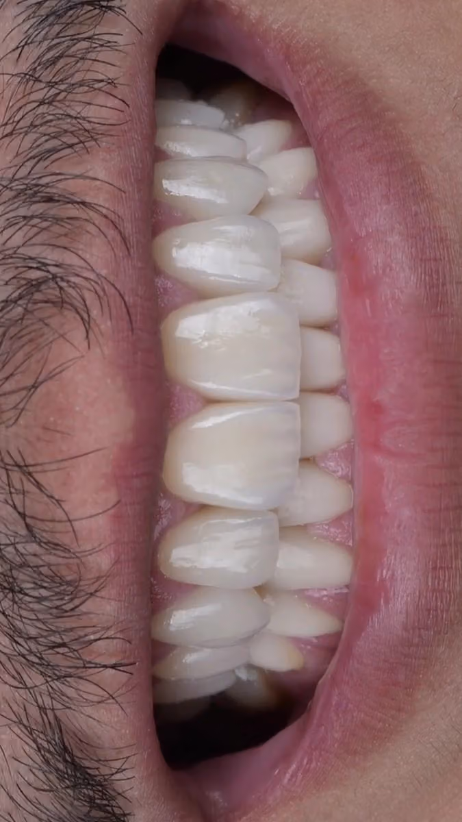 عيادات سافي لطب وتجميل الاسنان - Savvy Dental Clinics