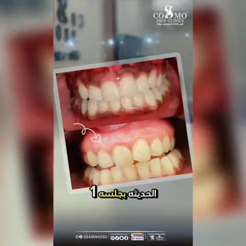 عيادات تجميل كوزمو بروف | جلدية وليزر وبشرة وجراحة تجميل وطب أسنان