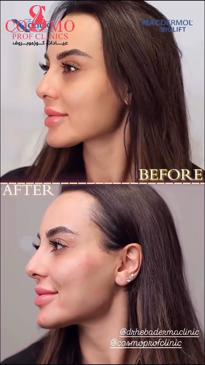 عيادات تجميل كوزمو بروف | جلدية وليزر وبشرة وجراحة تجميل وطب أسنان