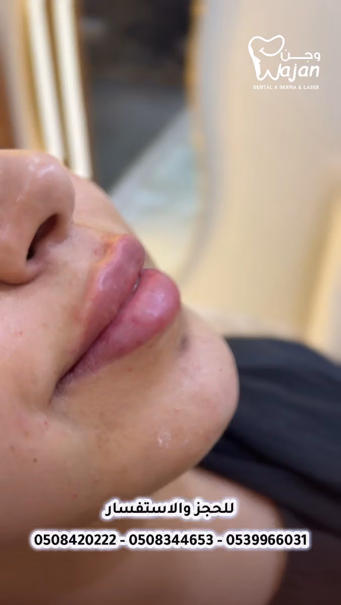 عيادات وجن للجلدية والتجميل والليزر - فرع الربوة