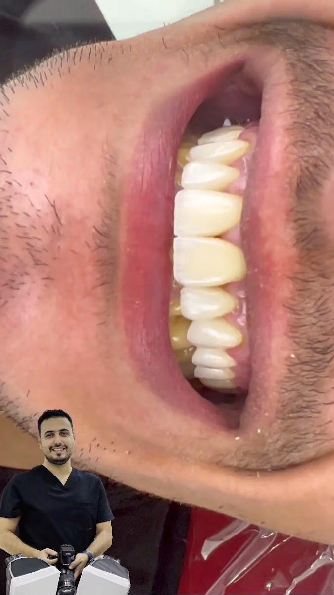 عيادة الدكتور بلال محمود لطب وجراحة و تجميل الأسنان