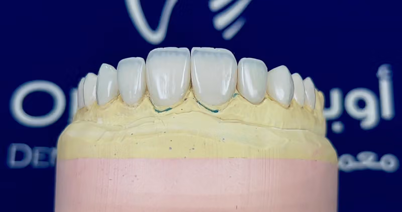 عيادة الدكتور بلال محمود لطب وجراحة و تجميل الأسنان
