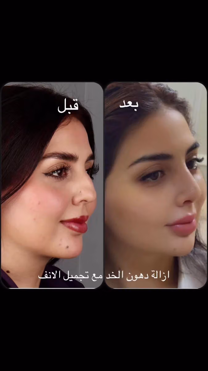 عيادة الدكتور حسان الخباز لجراحة الفم والوجه والفكين وتجميل الوجه