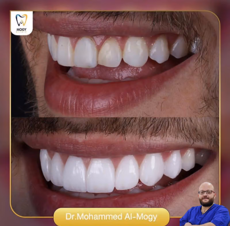 عياده الدكتور محمد الموجي لتجميل و زراعه الاسنان