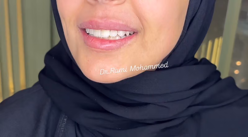 عيادة الدكتور رامي محمد طبيب تجميل الاسنان ( عيادات نيولوك )