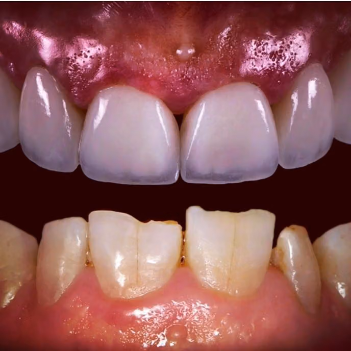 عيادة الدكتور سامر الحسن لطب وتجميل الاسنان