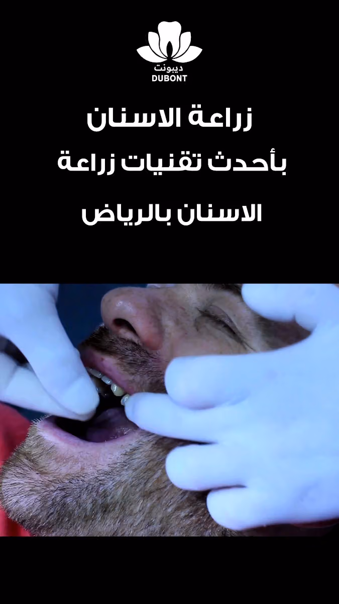 عيادة الدكتورة قمرعلبي طبيبة تجميل الاسنان ( ديبونت لطب وتجميل الأسنان )