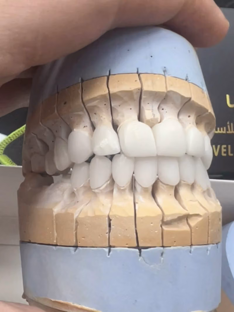 عيادة اسنان الدكتور محمد الزعبي.