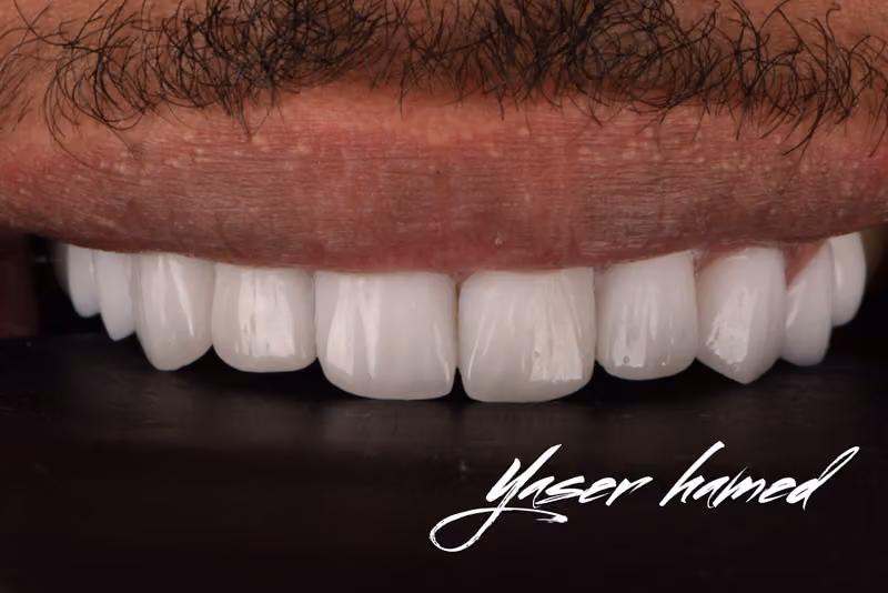 عيادة د ياسر حامد لطب وتجميل الأسنان