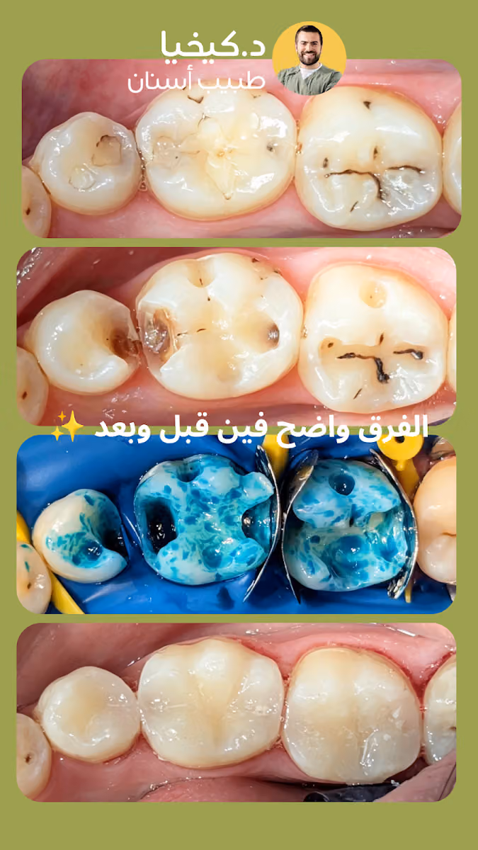 عيادة دكتور كيخيا 🦷طبيب اسنان في مجمع افق الابتسامة