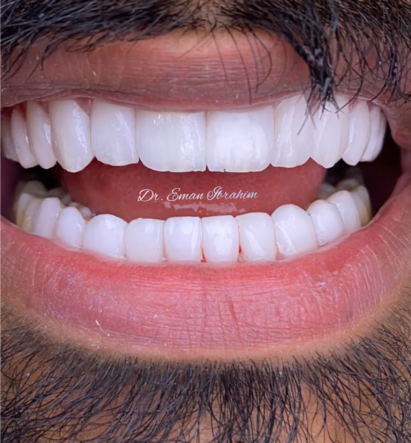 عيادة دكتورة إيمان ابراهيم لطب الاسنان