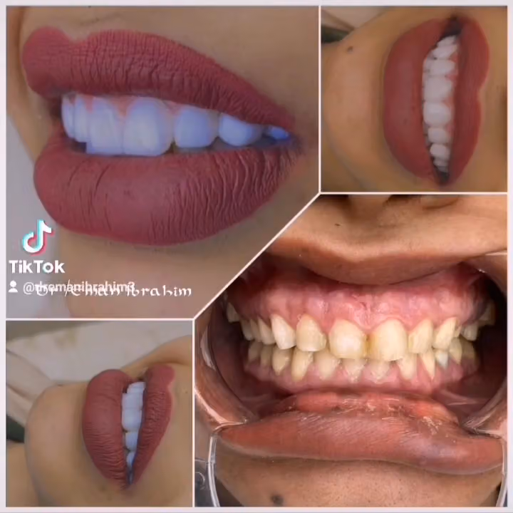 عيادة دكتورة إيمان ابراهيم لطب الاسنان