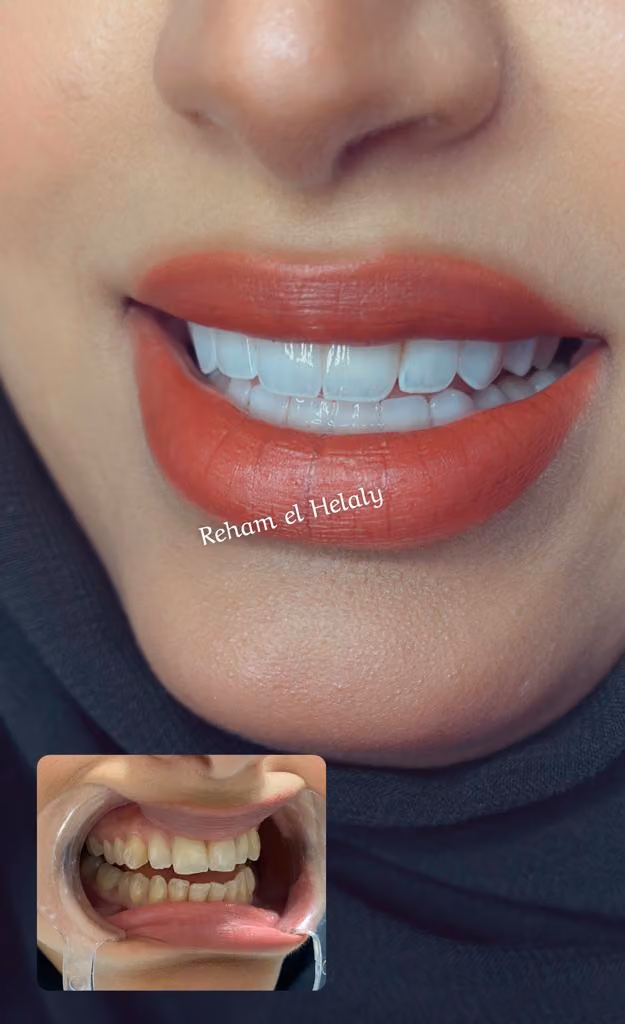 عيادة دكتورة ريهام الهلالي