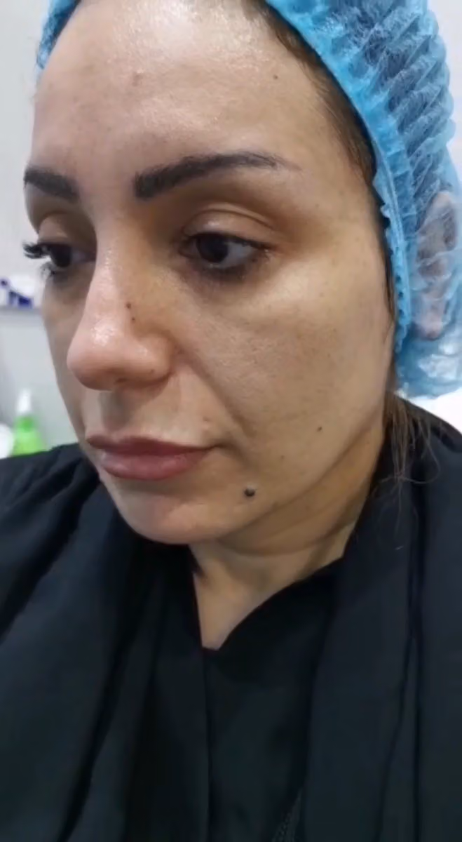 عيادة جلدية تجميل ليزر