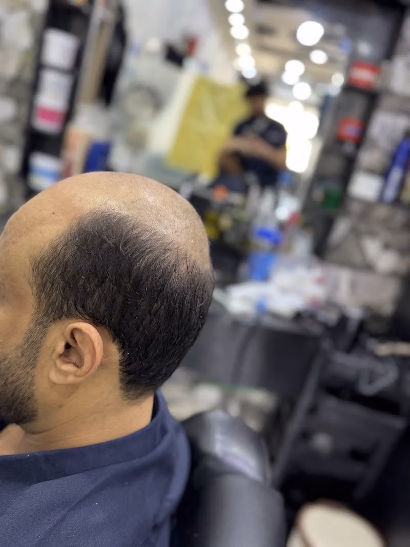أيمن هيبه لتركيب الشعر الرجالي