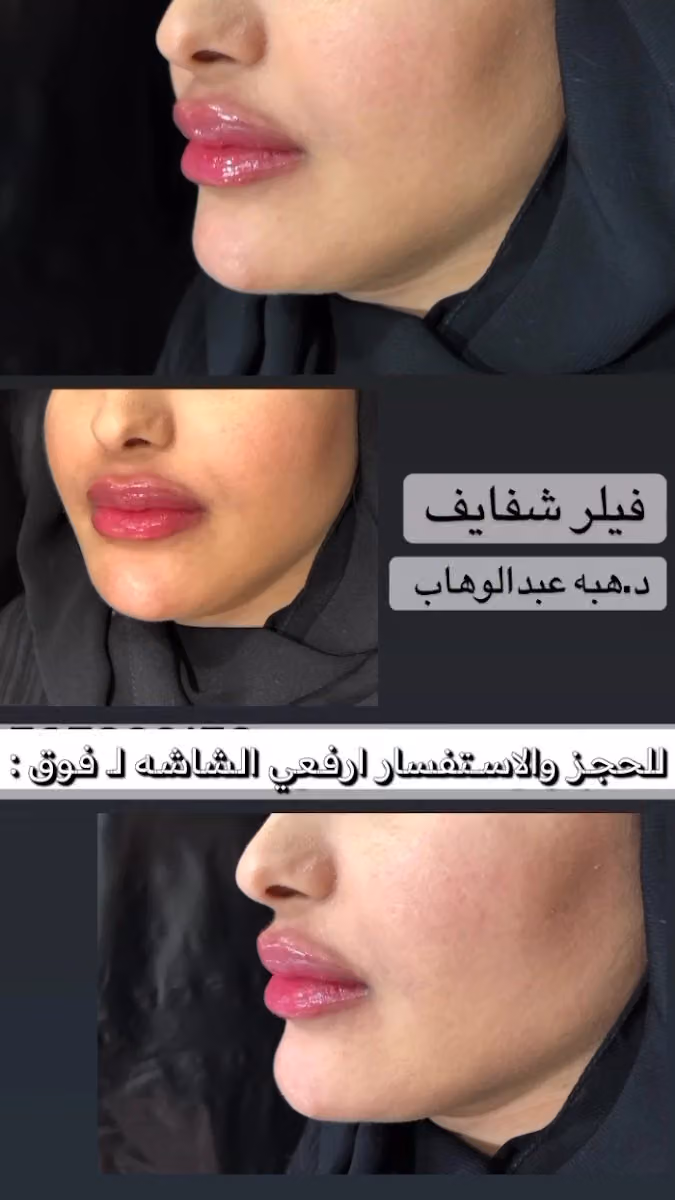 بيرل