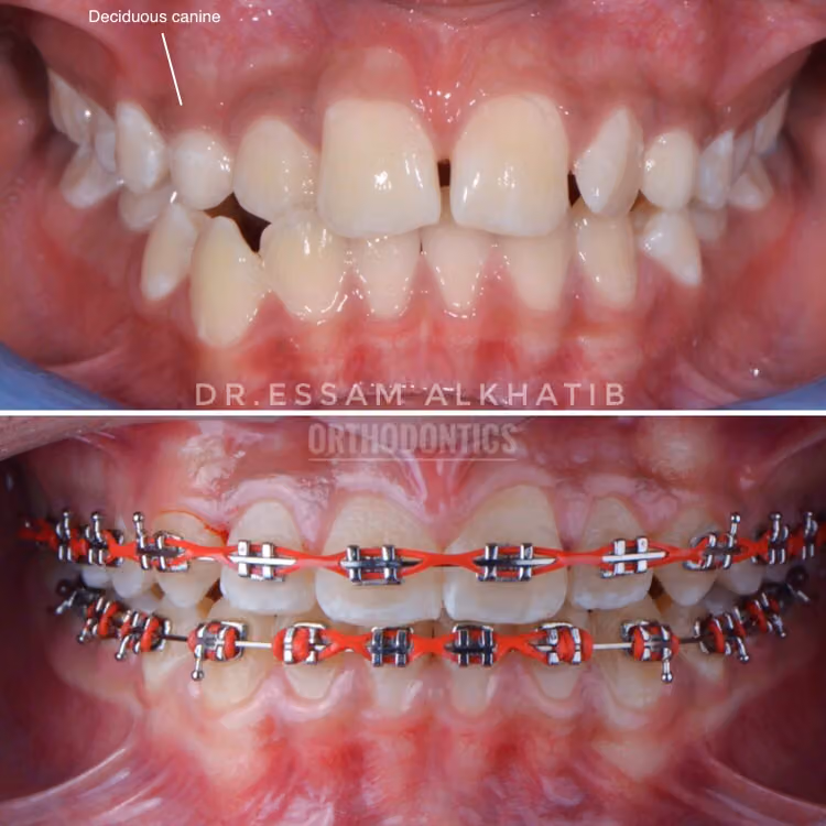 د/عصام الخطيب اخصائي تقويم اسنان وفكين Orthodontist