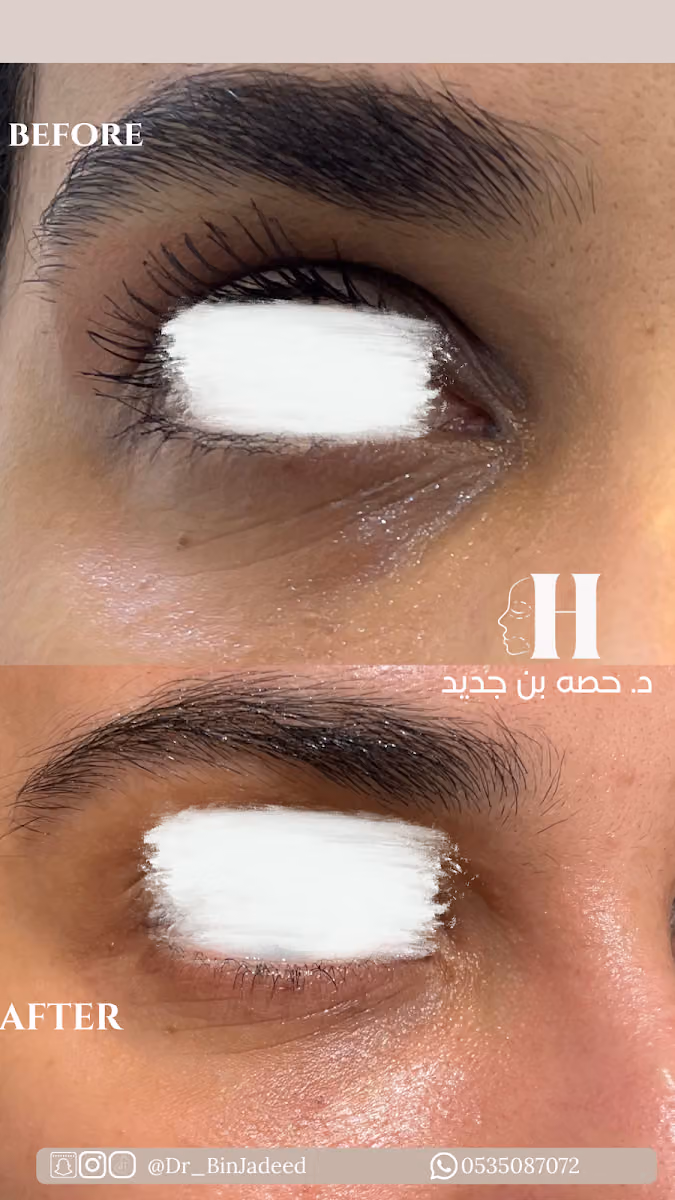 د حصه بن جديد