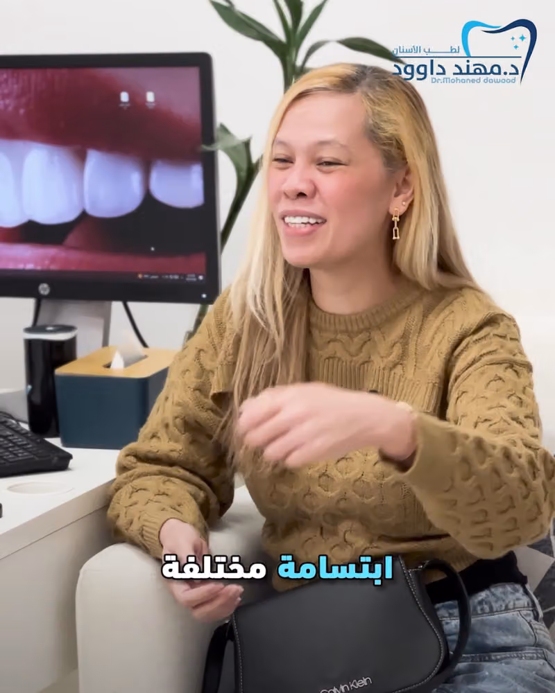 د. مهند العيسوي – تجميل الأسنان والفينير