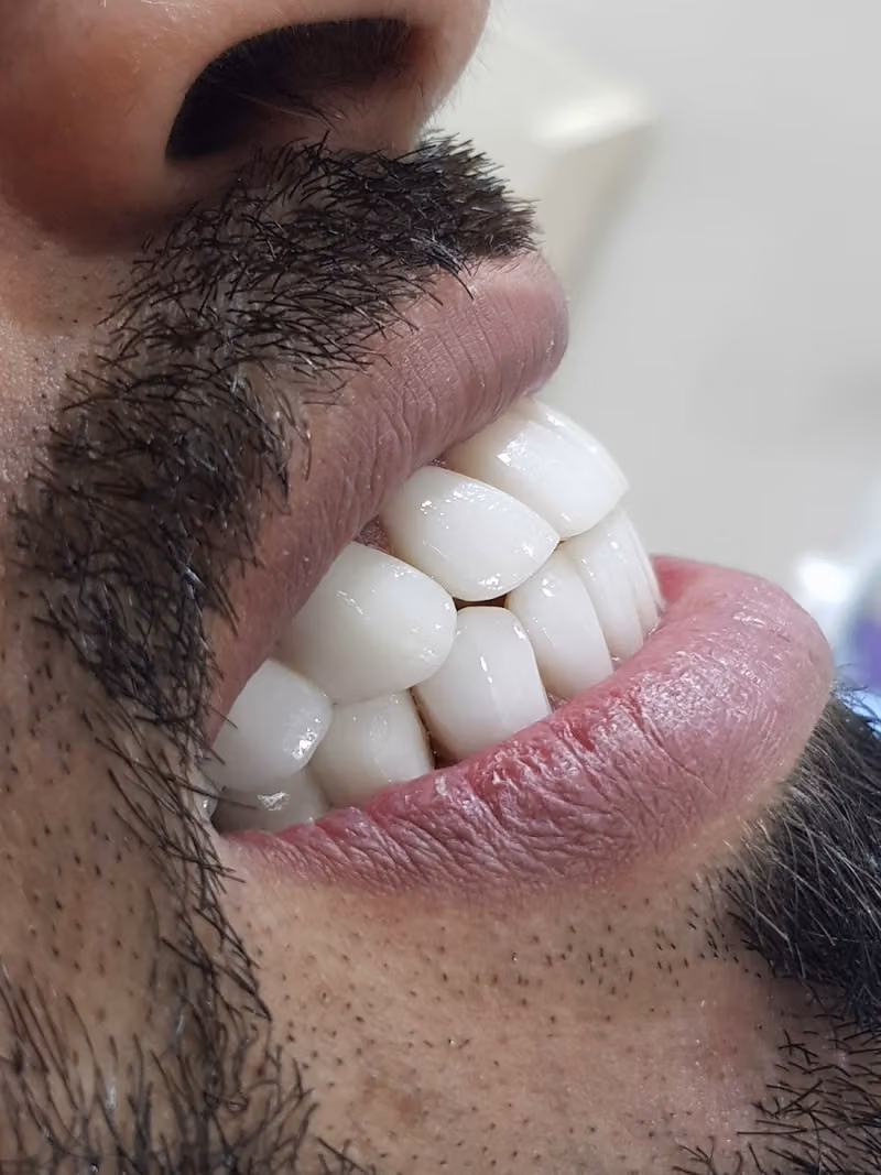 د.الحسيني محمد استشاري جراحة الوجه والفكين