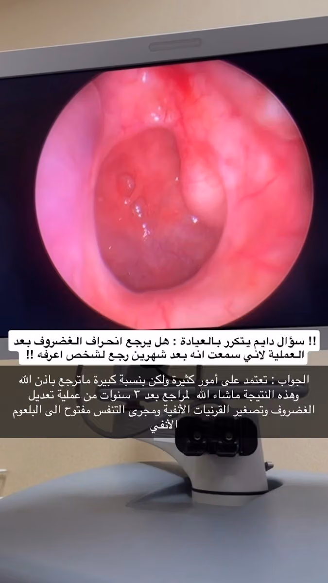 د.حاتم الزهراني استشاري جراحة الأنف ومناظير الجيوب الأنفية