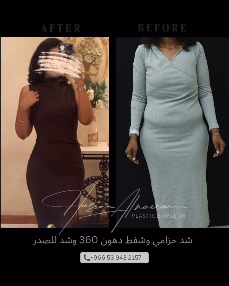 Dr Hassan Alnaeem Plastic Surgeon