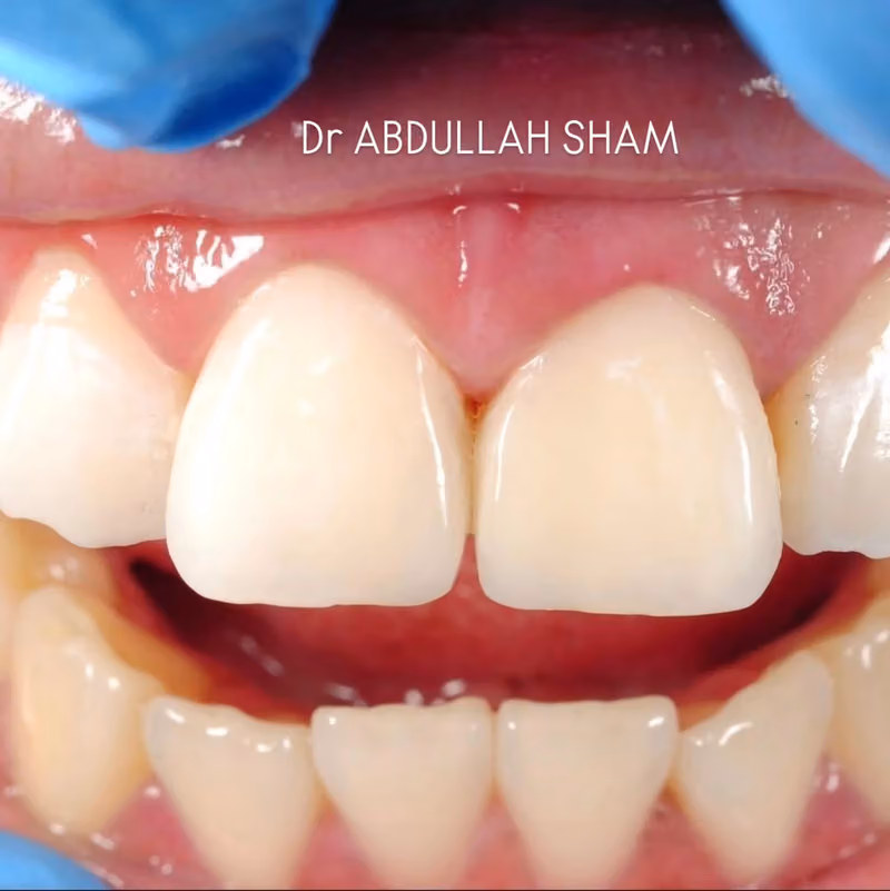 Dental clinic medical consultant Dr. Abdullah عيادة أسنان د.عبدالله شام