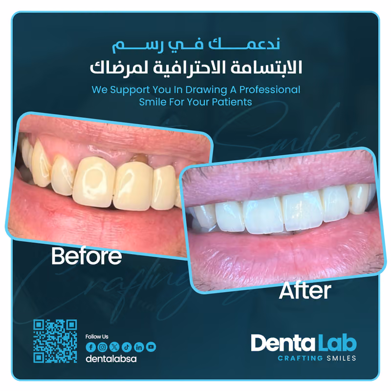 Dentalab معمل دنتا للأسنان