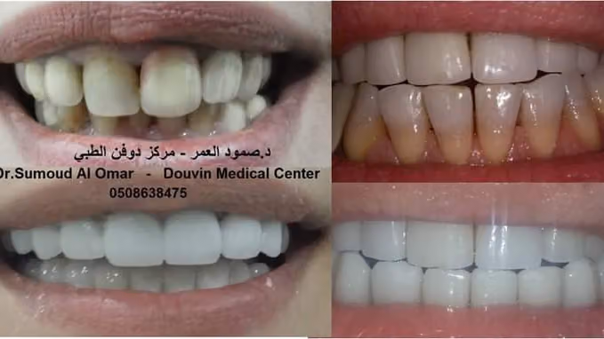 Dentist Sumoud طبيب الأسنان صمود العمر